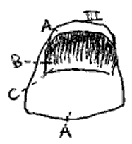 Figure III